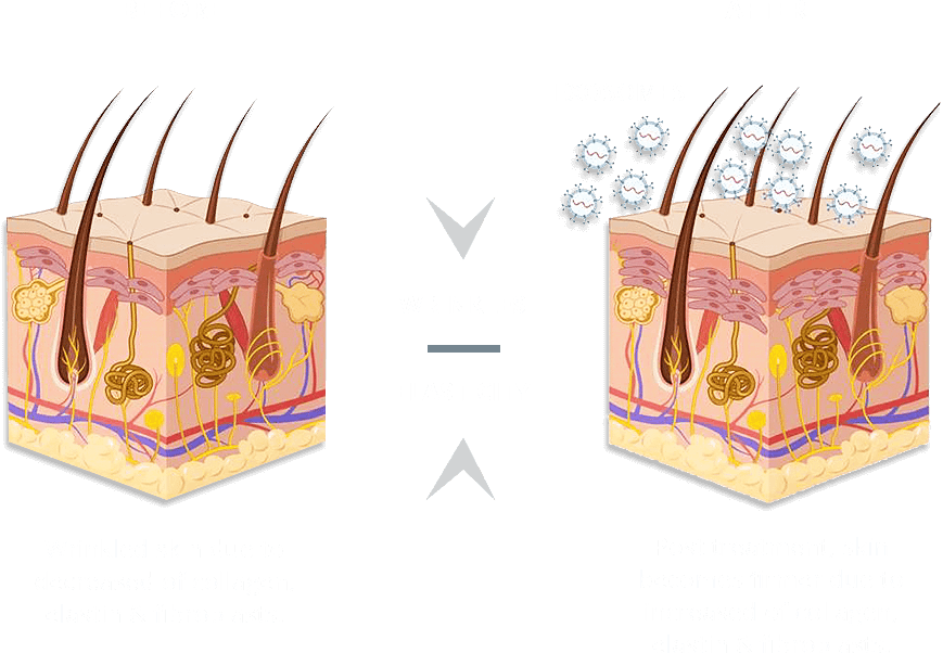 Wrinkles Elasticity